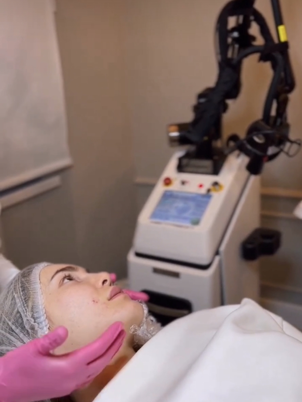 коррекция рубцов на аппарате омоложение лица на аппарате GRAND CELL RF коррекция рубцов на аппарате омоложение лица на аппарате GRAND CELL RF