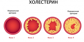 Важная информация для сохранения нормального уровня холестерина 