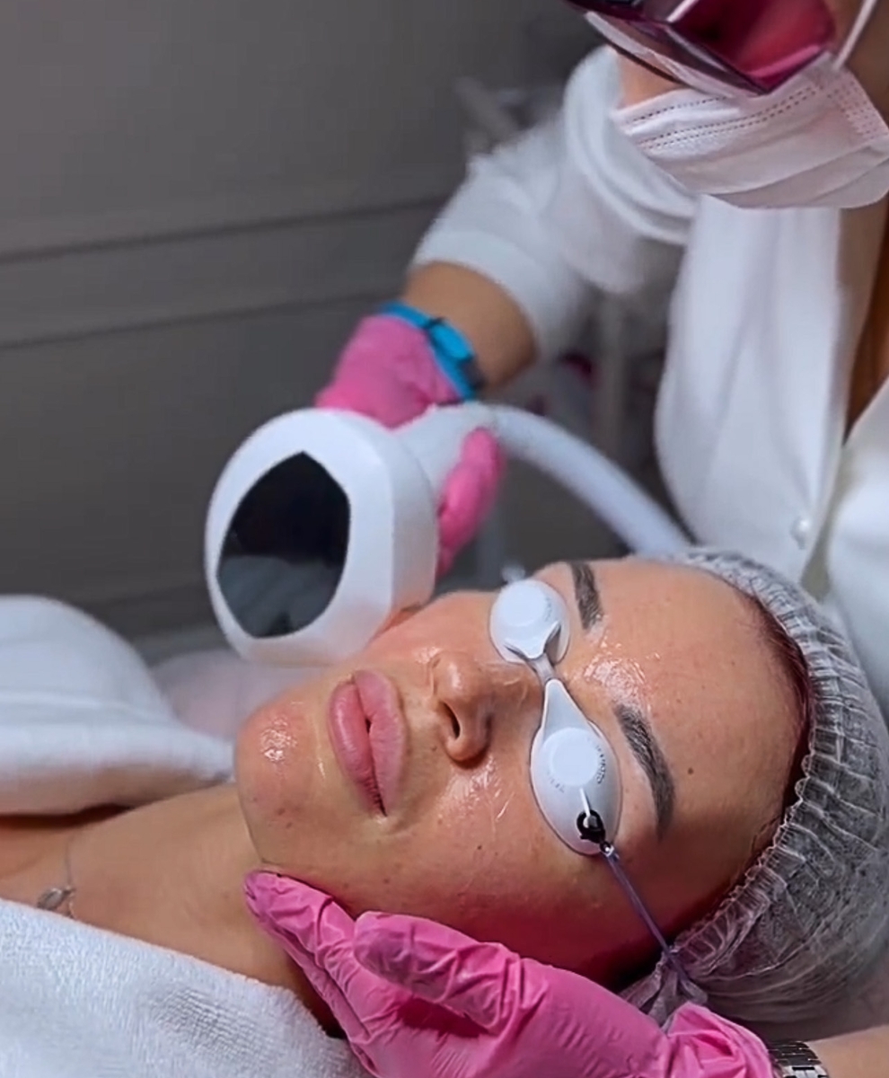 ФОТООМОЛОЖЕНИЕ