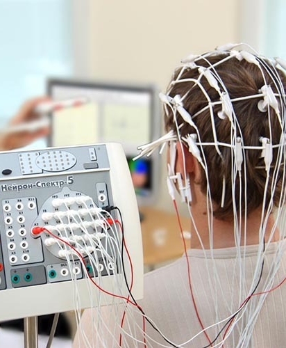 Симптомы эпилепсии