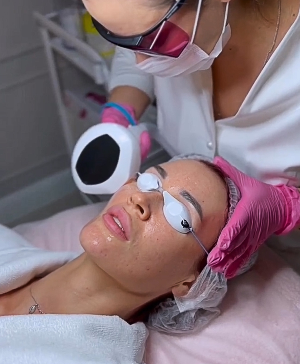 ФОТООМОЛОЖЕНИЕ