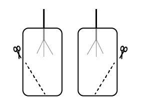 Электроды для аппарата Тенс Ова +