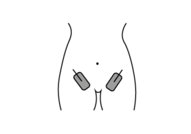 Купите дополнительные накладки для аппарата Тенс Каре Ова