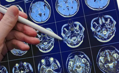 Виды приступов и принципы лечения приступов эпилепсии