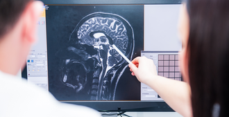 Петнидан от эпилепсии