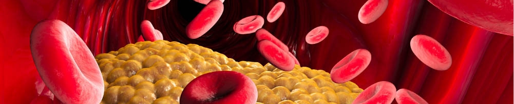 Всё о правильной сдаче крови на холестерин