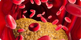 Всё о правильной сдаче крови на холестерин