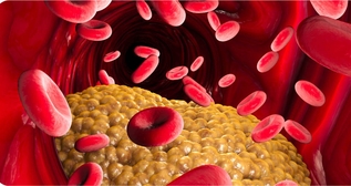 Как правильно сдавать анализ на холестерин?