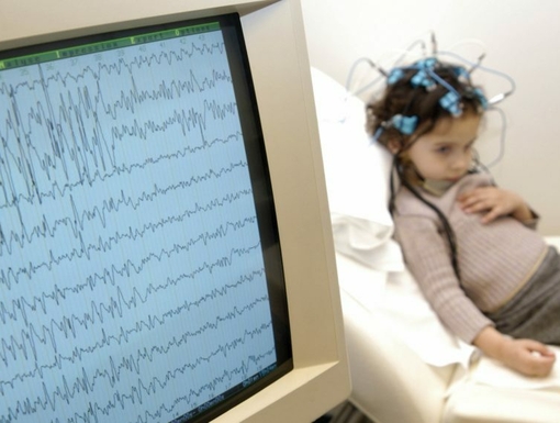 Эпилепсия у детей до з лет