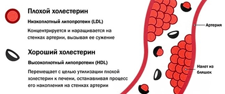 Лекарства, понижающие холестерин