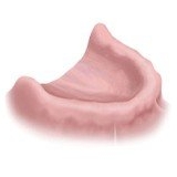 Полное отсутствие зубов