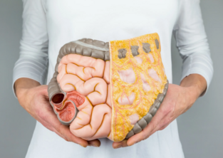 Купить Холестирамин