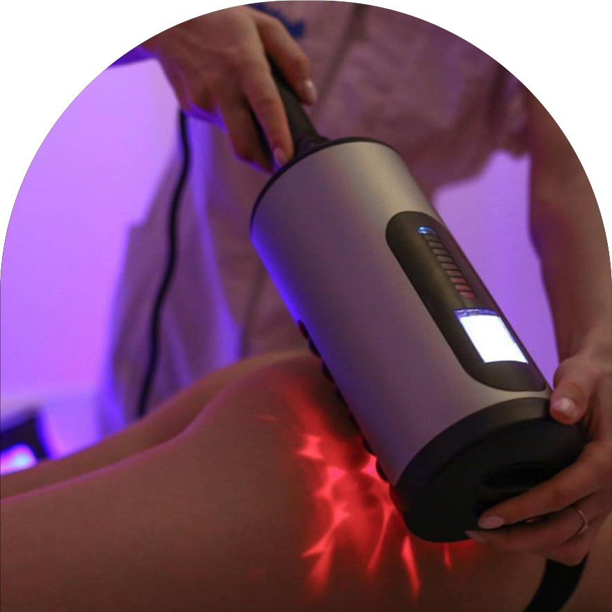 аппарат RSL (BEAUTY LAZER)