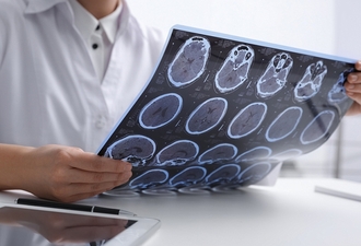 Лечении резистентной формы эпилепсии Петнидан