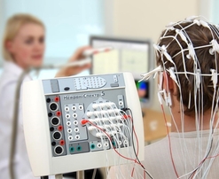 Медикаментозное лечение резистентной эпилепсии.