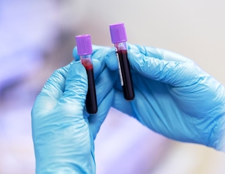 Купить Осполот по выгодной цене с инструкцией по применению