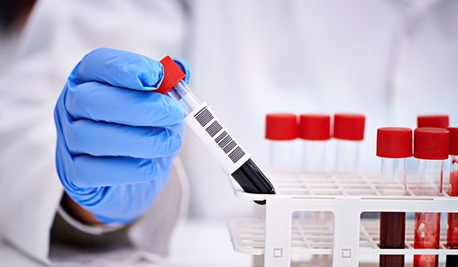 Повышенный холестерин влияет на самочувствие