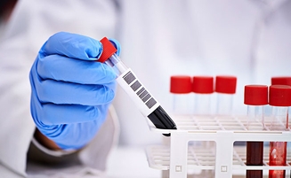 Повышенный холестерин влияет на самочувствие