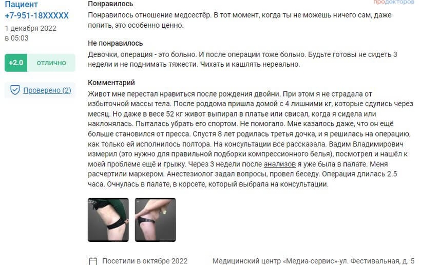 Пластика тела отзыв 4 - скриншот