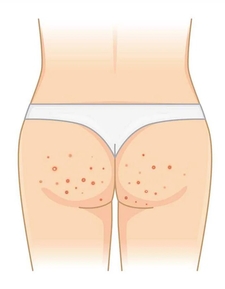 Польза глутатиона в Татионил 600 для оздоровления организма 