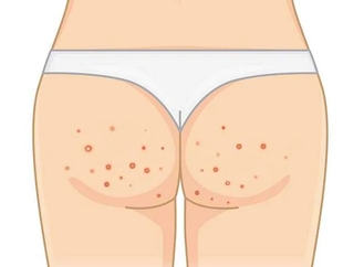 Польза глутатиона в Татионил 600 для оздоровления организма 